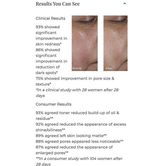 NIB PERRICONE MD No:Rinse Intensive Pore Minimizing Toner BHA AHA Salicylic Acid - Picture 6 of 11